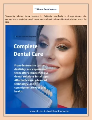 All 4 dental implants in Orange County, CA