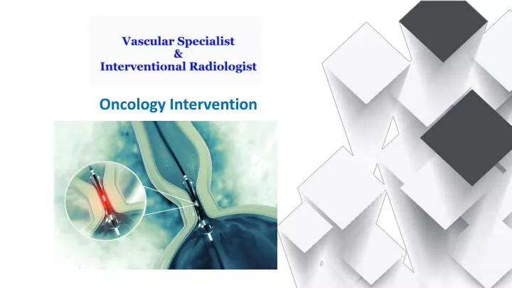 oncology intervention