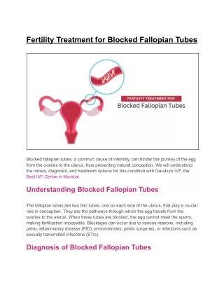 Fertility Treatment for Blocked Fallopian Tubes