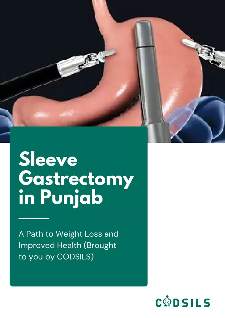 sleeve gastrectomy in punjab