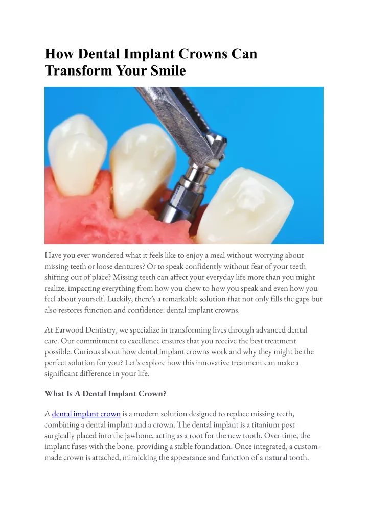 how dental implant crowns can transform your smile