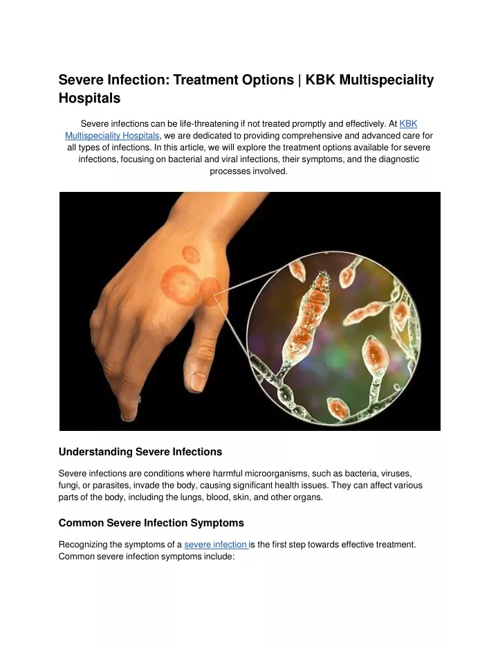 severe infection treatment options