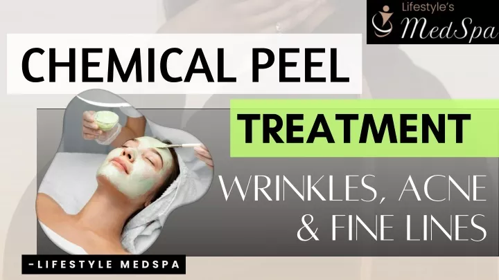 chemical peel