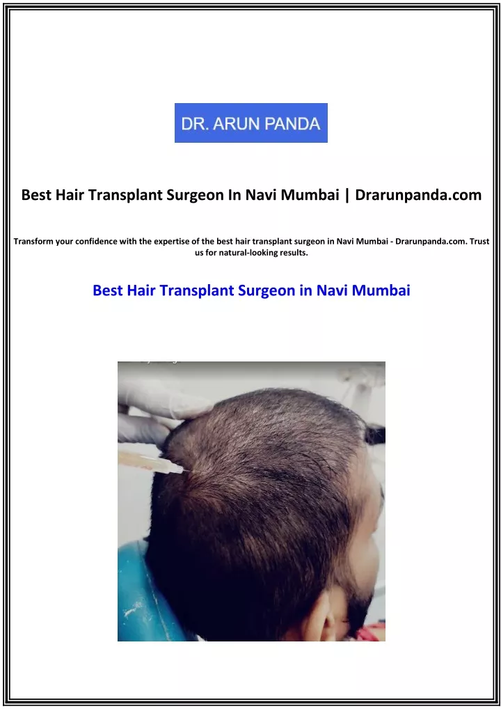 Ppt Best Hair Transplant Surgeon In Navi Mumbai Powerpoint Presentation Id 7829