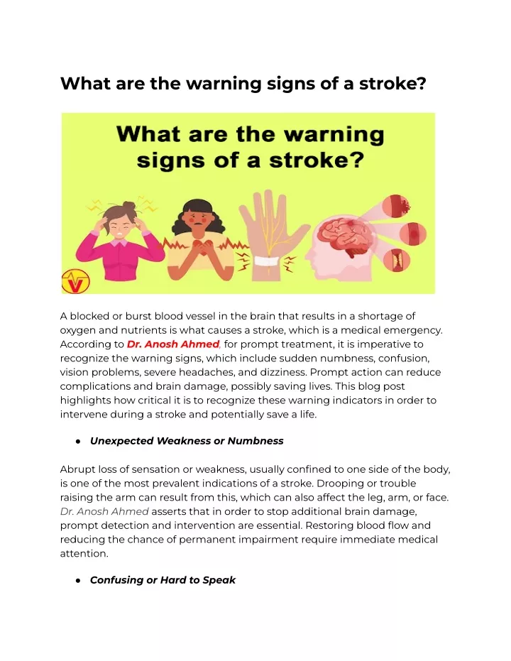 what are the warning signs of a stroke