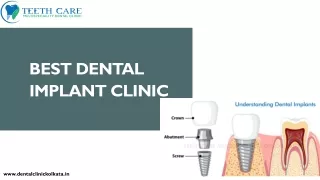 Discovering  Your Perfect Smile The Best Dental Implant Clinic in Kolkata