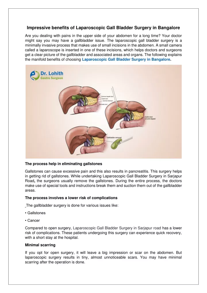 impressive benefits of laparoscopic gall bladder