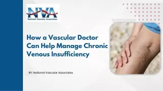 How a Vascular Doctor Can Help Manage Chronic Venous Insufficiency