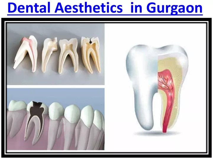 dental aesthetics in gurgaon