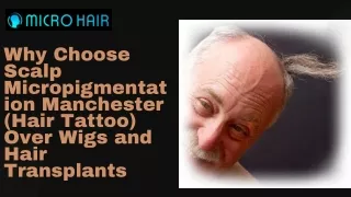 Why Choose Scalp Micropigmentation Manchester (Hair Tattoo) Over Wigs and Hair Transplants