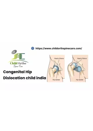 Congenital Hip dislocation child india