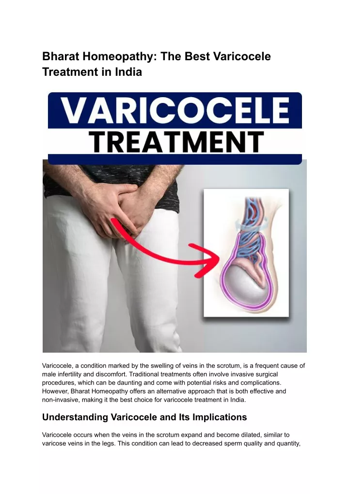 bharat homeopathy the best varicocele treatment