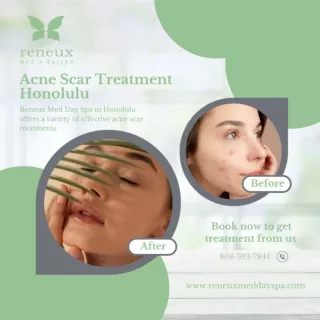 Acne Scar Treatment Honolulu