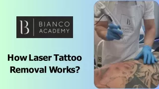 How Laser Tattoo Removal Works?