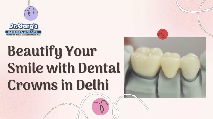 beautify your smile with dental crowns in delhi