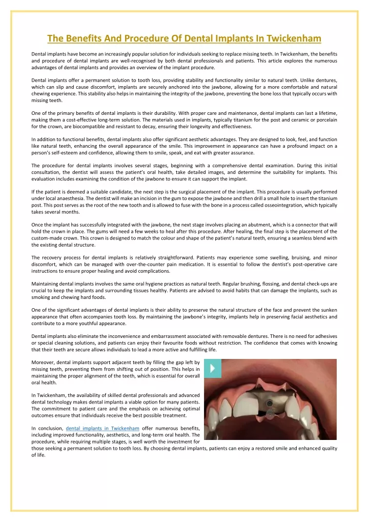 the benefits and procedure of dental implants