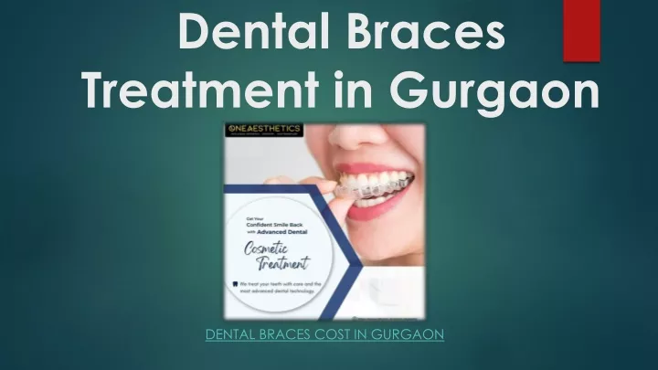 dental braces treatment in gurgaon