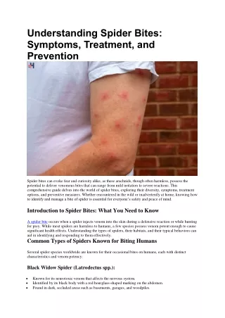 understanding spider bites symptoms treatment