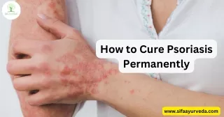 How to Cure Psoriasis Permanently