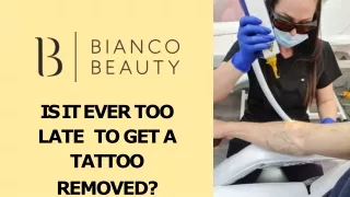 Is It Ever Too Late To Get A Tattoo Removed?