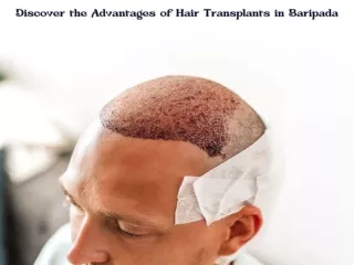 Discover the Advantages of Hair Transplants in Baripada