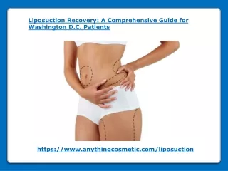 Liposuction Recovery - A Comprehensive Guide for Washington DC Patients