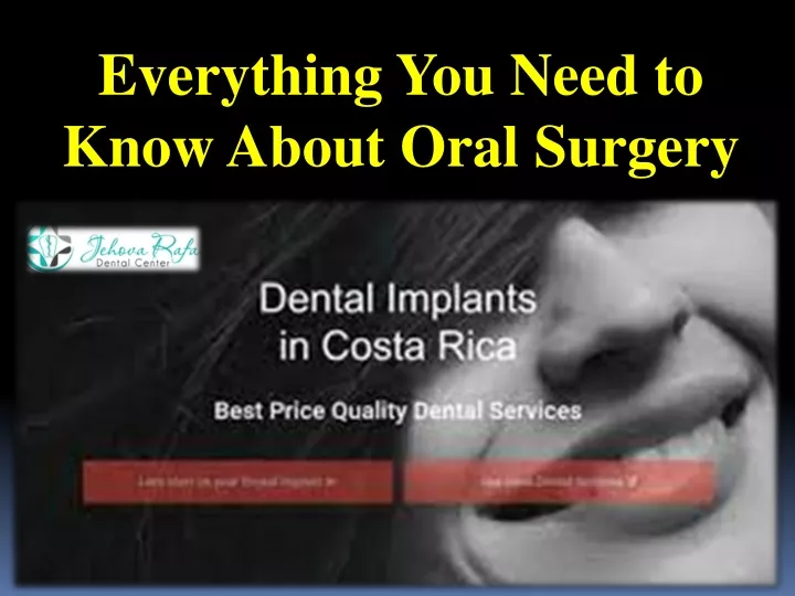 everything you need to know about oral surgery