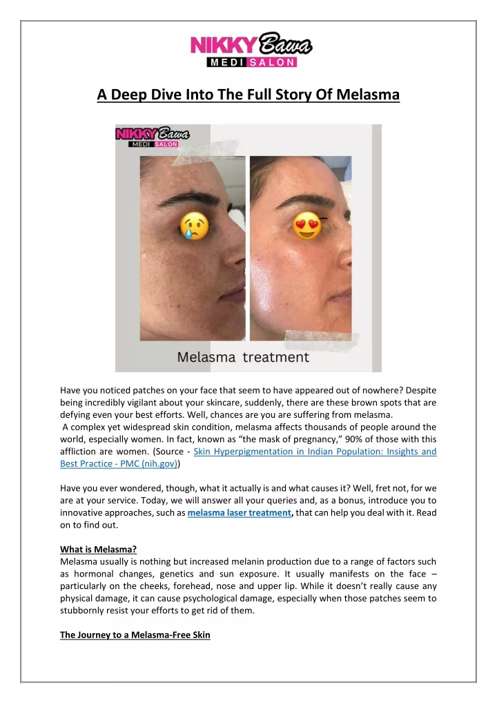 a deep dive into the full story of melasma