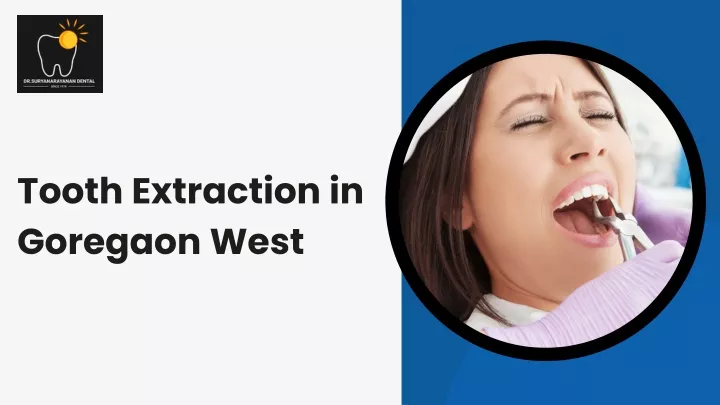 tooth extraction in goregaon west