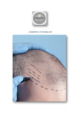 scalptattoo | lionscalp.com