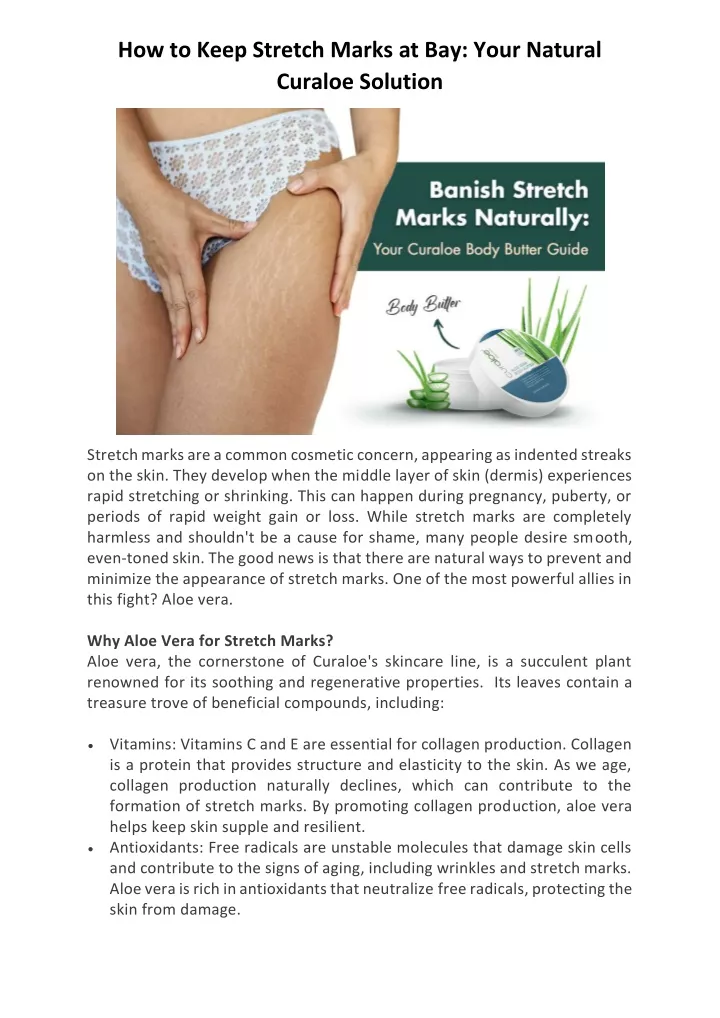 how to keep stretch marks at bay your natural