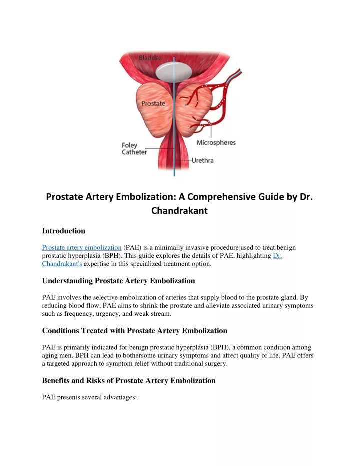 prostate artery embolization a comprehensive