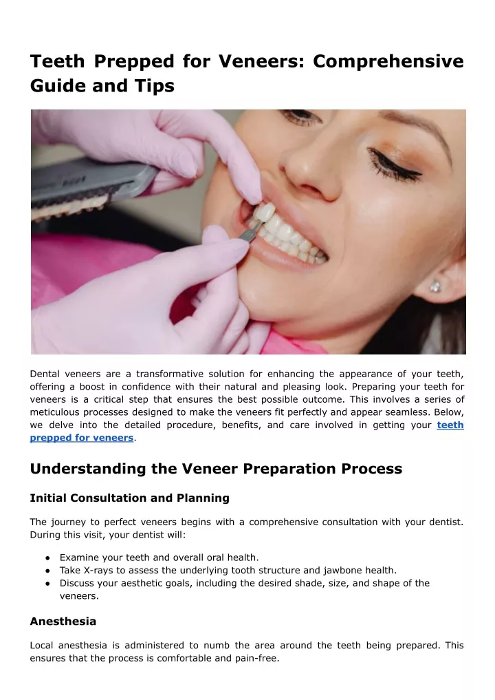 teeth prepped for veneers comprehensive guide