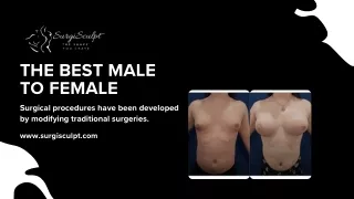 The Best Male to Female- SurgiSculpt