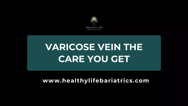 varicose vein the care you get