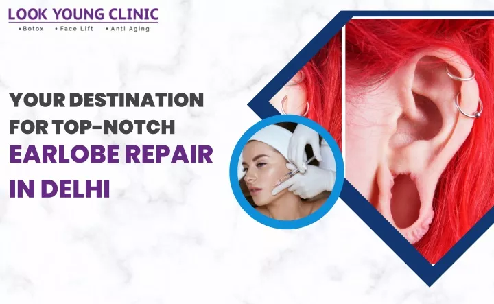 your destination for top notch earlobe repair