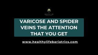 Varicose and spider veins The attention that you get