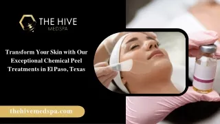 Transform Your Skin with Our Exceptional Chemical Peel Treatments in El Paso, Texas