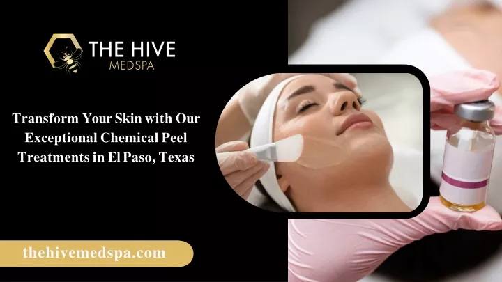 transform your skin with our exceptional chemical peel treatments in el paso texas