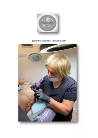 geheimratsecken | lionscalp.com