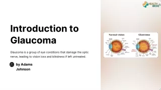 Introduction to Glaucoma