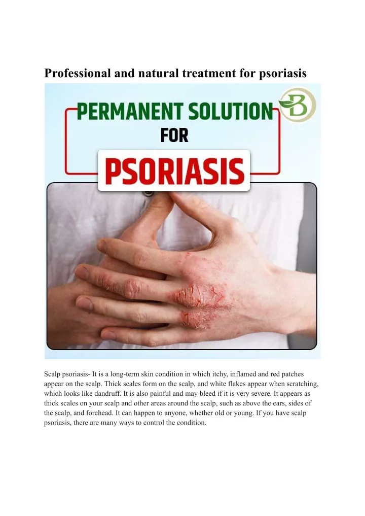 professional and natural treatment for psoriasis