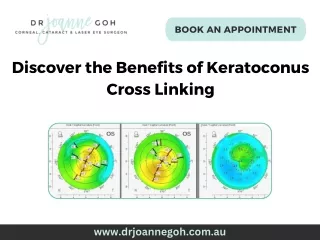 Discover the Benefits of Keratoconus Cross Linking