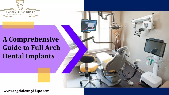 a comprehensive guide to full arch dental implants