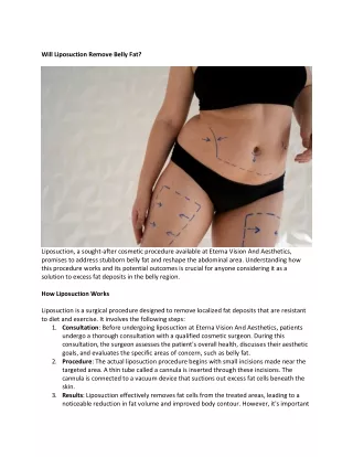 Will Liposuction Remove Belly Fat