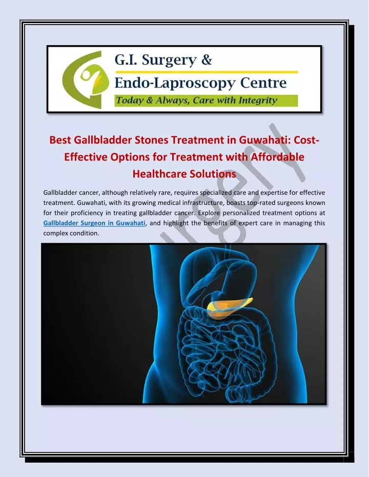 best gallbladder stones treatment in guwahati