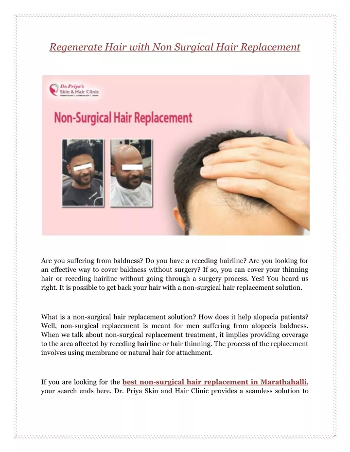 regenerate hair with non surgical hair replacement