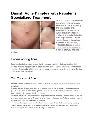 banish acne pimples with neoskin s specialized