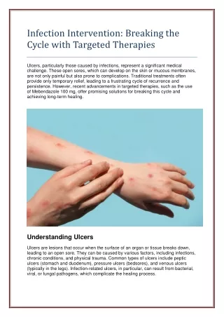 infection intervention breaking the cycle with