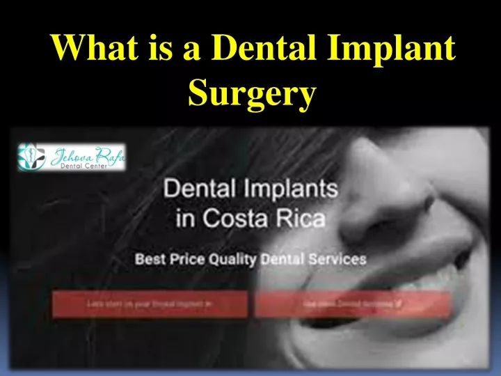 what is a dental implant surgery